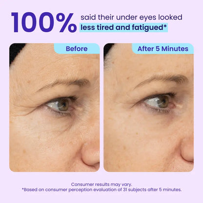 NEW! SEATLIKE Instant Lift Eye Gel - For Puffiness & Bags, Wrinkles, Fine Lines and Dark Circles, Anti Aging Skin Care for Men & Women with Collagen Targeting Biotech-9SLL