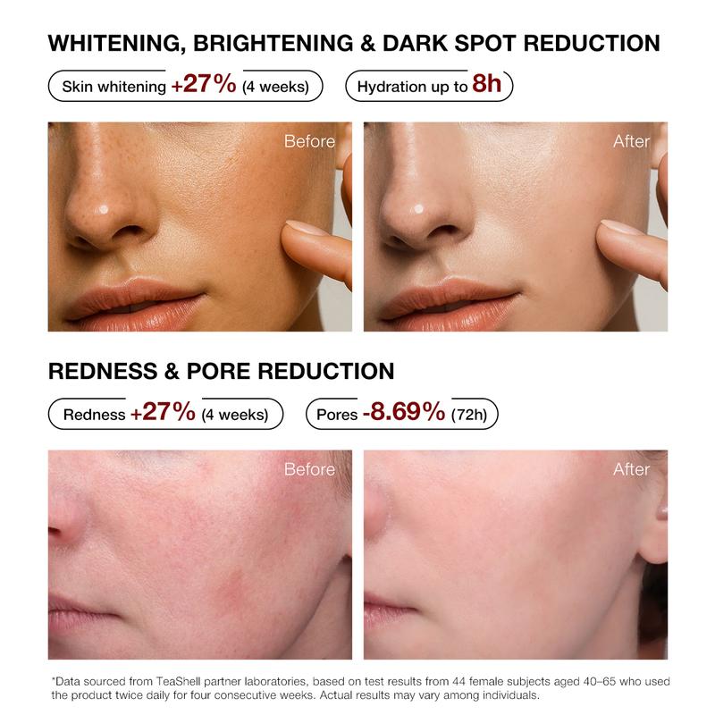 【JMCY × Teashell】Whitening Serum 5% Niacinamide🌿|Reduces Dark Spots, Brightens Skin,  Suitable for Sensitive Skin-918