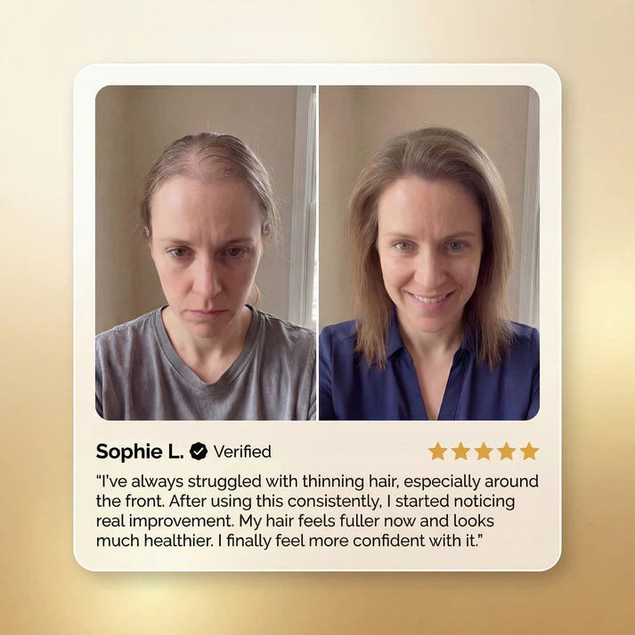 【SEATLIKE】 Advanced Batana Hair Regrowth Therapy🌿| For thinning hair, sparse edges, and a healthier-looking scalp-918