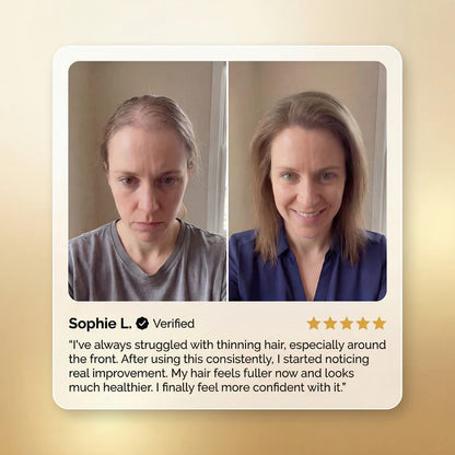 【SEATLIKE】 Advanced Batana Hair Regrowth Therapy🌿| For thinning hair, sparse edges, and a healthier-looking scalp-918
