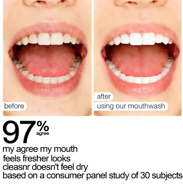 SEATLIKE Whitening Mouthwash for Surface Stains & Fresh Breath-9SLL