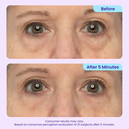 NEW! SEATLIKE Instant Lift Eye Gel - For Puffiness & Bags, Wrinkles, Fine Lines and Dark Circles, Anti Aging Skin Care for Men & Women with Collagen Targeting Biotech-9SLL