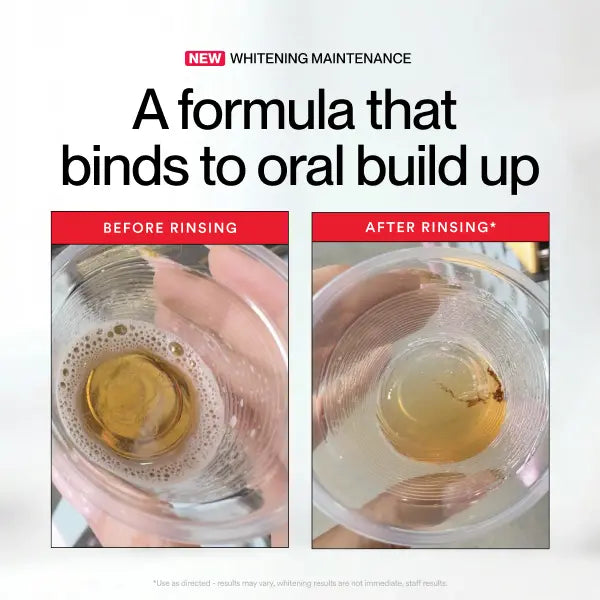 ✨ VELORA Stain Whitening   Mouthwash 🌿 | Brighten Your Smile   & Freshen Your Breath with Essential   Oils 🦷 💨 | 237ml-918