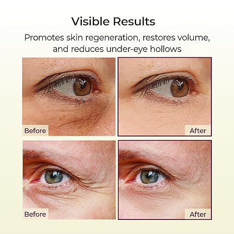 [Dr.Melaxin] Cemenrete Calcium Volume Multi Balm 9g- Boosts collagen, Elasticity, Firmness-A