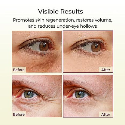 [Dr.Melaxin] Cemenrete Calcium Volume Multi Balm 9g- Boosts collagen, Elasticity, Firmness-A