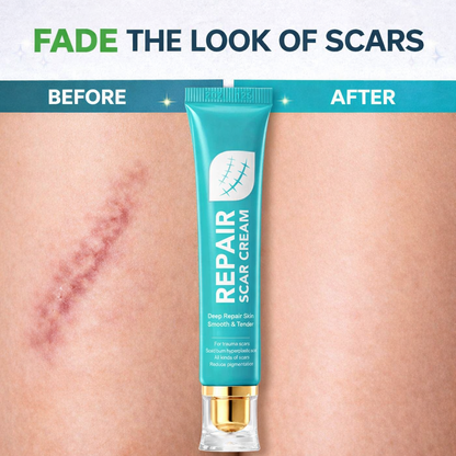 ✨Scar Repair Cream🌿|Treats Old and New Scars, Burns and More-918