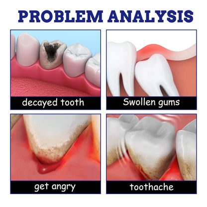 🦷 SEATLIKE TOOTHACHE RELIEF SPRAY|✨ SAY GOODBYE TO TOOTH PAIN AND HELLO TO A FRESHER SMILE-9SLL